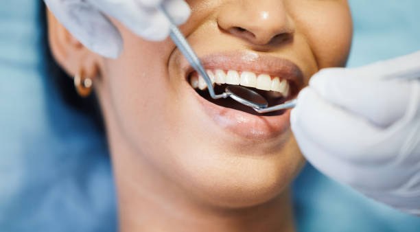 Best Emergency Gum Treatment in Ironton, OH