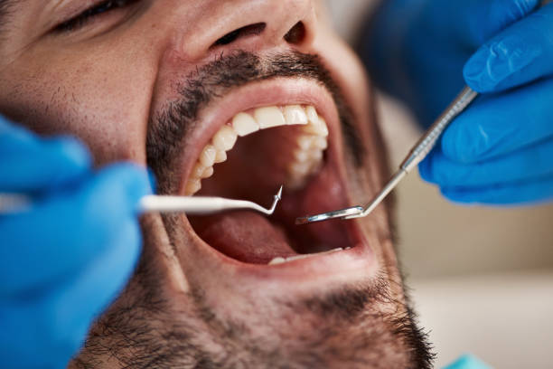 Best Emergency Treatment for Dental Infections or Abscesses in Ironton, OH